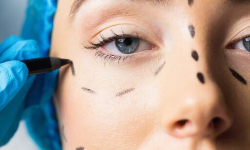 Cuidados Pré-operatórios para cirurgia plástica: entenda mais como se preparar!